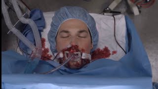 DeLuca Dies  Greys Anatomy Season 17 Episode 7 [upl. by Aninahs]