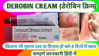 Derobin cream fullriview derobin cream ko use karne ka sahi tarika drviralmedical [upl. by Yraillih]