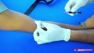 How To Do Venous Blood Sampling Venipuncture  StepbyStep Description of Procedure  Clinicals [upl. by Leff]