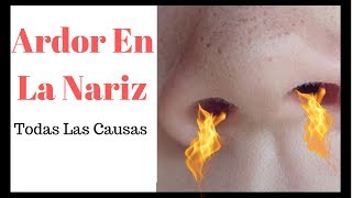 Porque Me Arde La Nariz Por Dentro ⇨【Ardor Nasal o Ardor En La Nariz Descubre Todas Las Causas 】 [upl. by Smith]