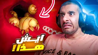 دخلت بطن الناس ولقيت اشياء جدا غريبة وصادمة 😰😰  Revenge of the Colon [upl. by Selima]