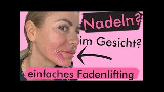 PDO FADENLIFTING für das Gesicht im Selbsttest  Vorher Nachher Ergebnis [upl. by Yessak]