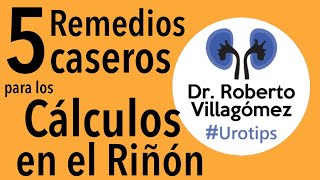 Los REMEDIOS CASEROS que funcionan MEJOR para piedras urotips [upl. by Ennovyahs]