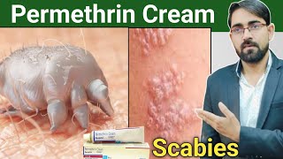 permethrin cream uses in hindi  scabies treatment in hindi  scabies permethrin cream Drx Rabbani [upl. by Airetas]