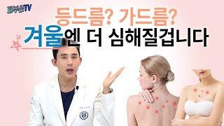 등드름 가드름 없애는 방법 모르면 더 심해집니다 피부과전문의 피부심 [upl. by Aneeh403]