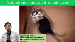 Ocular diplopia  understanding double vision [upl. by Neenwahs556]