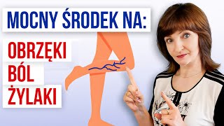 Mocny środek na ból OBRZĘKI nóg i ŻYLAKI Zmniejsz żylaki odmłódź nogi 3 sposoby [upl. by Cristobal843]