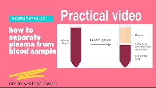 How to separate plasma from blood [upl. by Chappie]