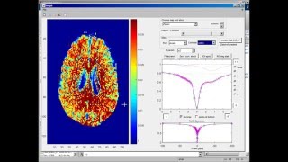 CEST MRI data evaluation tool part 22  Lorentzian fitting [upl. by Hector639]