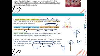 Endodontics lec 3 fourth stage [upl. by Notyad718]