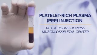 PlateletRich Plasma PRP Injections  QampA [upl. by Scharf]