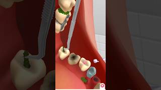 teeth cleaning by animation animation treatment kidsvideo satisfying relax [upl. by Noxas48]