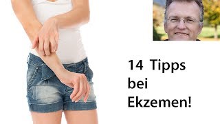 14 Tipps um Ekzeme behandeln [upl. by Kcered700]