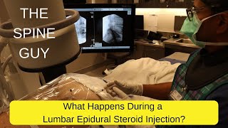 What Happens During a Lumbar Epidural Steroid Injection [upl. by Petrie]