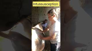 Intussusception l Dr Umar Khan [upl. by Pompei724]