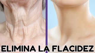 ELIMINAR ARRUGAS Y FLACIDEZ EN EL CUELLO ✨ Ejercicios para un Cuello Joven y Firme [upl. by Chenay735]