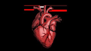 EJECTION FRACTION CARDIAC OUTPUT What is stroke volume End Diastolic Volume EXPLAINED [upl. by Adar359]