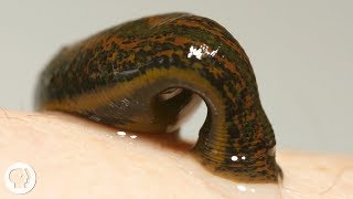 Take Two Leeches and Call Me in the Morning  Deep Look [upl. by Sandeep]