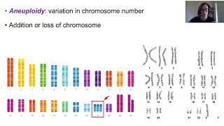 Chromosome abnormalities [upl. by Soble943]