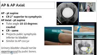 Urinary Imaging Radiology  3 Cystogram [upl. by Hteboj842]