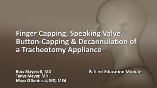 Finger Capping Speaking Valve ButtonCapping amp Decannulation of a Tracheotomy Appliance [upl. by Elvira]