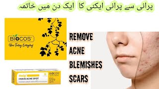 Biocos Acne Cream  Anti Acne Cream  Remove blemishes  Scars in First Application [upl. by Odnamra]