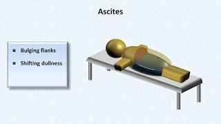 Cirrhosis  Physical Findings [upl. by Nnylhsa161]