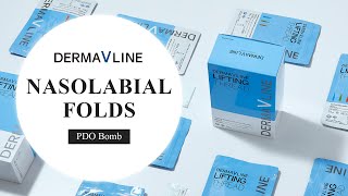 DERMAVLINE PDO BombNasolabial Folds [upl. by Ecirtap]