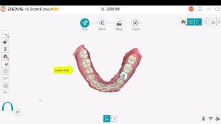 05 DEXIS IS SCanFlowHow to use Tools in the quotSCANquot Step [upl. by Esadnac]