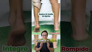 Ruptura do Tendão de Aquiles😱🦵 medico medicina curiosidades curiosidademedicina enfermeira [upl. by Oad536]