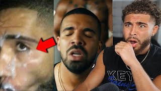 Kendrick Lamar L3AKS WILD Video Of BBL DRIZZY  Drake [upl. by Holtorf]