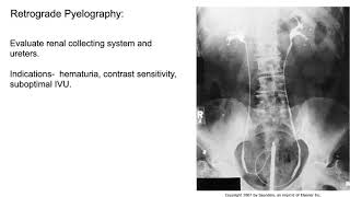 Radiology of the Urogenital system [upl. by Haikezeh795]