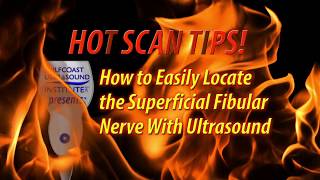 Hot TipHow to Easily Locate the Superficial Fibular Nerve with Ultrasound [upl. by Heise]