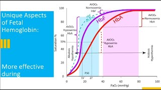 Precision Medicine Approach to Management of PPHN [upl. by Todhunter]