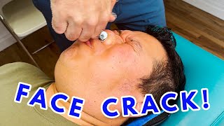 TMJ RELIEF AFTER ONE ADJUSTMENT  A FACE CRACK [upl. by Grieve]