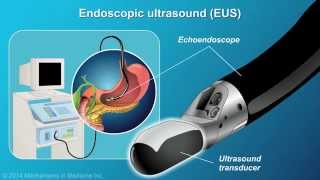 Understanding EUSFNA [upl. by Ahsii693]