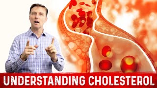 How to Read and Understand Your Cholesterol Levels [upl. by Ahsitul375]