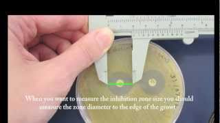 Microbiology resources  Callipers and Vernier Scale [upl. by Surdna795]