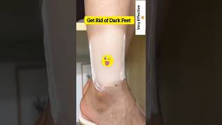 🔥Get Fair Feet  Easy Suntan Removal Pack At Home RemoveSuntan shortsytshortssuntandiyviral [upl. by Atiker301]