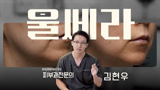 울쎄라 총정리 이 한 편만 보시면 됩니다 feat 전후 효과 부작용 원리 [upl. by Feldstein]