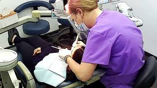 Teeth cleaning for teen  Tartar Removal by dental hygienist [upl. by Tolmann429]