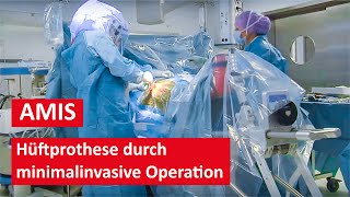 Hüftprothese durch minimalinvasive AMIS Methode  Live Operation [upl. by Pandich]