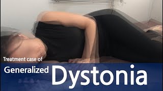 Generalized Dystonia  Abdominal dystonia  Immediate response within first treatment  전신 사경증 [upl. by Sualk]