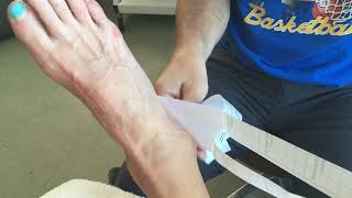 Peroneal Taping for lateral ankle and foot symptoms [upl. by Els]