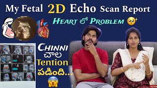 My Fetal 2D Echo Scan Report  Heart లో Problem😩  Chinni Tention  Santhoshivarma  Ravivarma [upl. by Vergil]