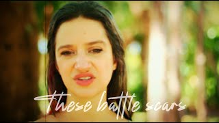 Battle Scars  Chloe Dolandis [upl. by Zara]