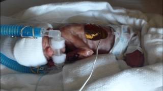 Our 27 week old preemie 115 lb miracle  Kaitlyns First Year [upl. by Ultann]