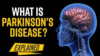 What Causes Parkinsons Disease  Explained [upl. by Zinah66]