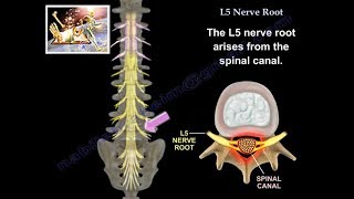 L5 Nerve Root  Everything You Need To Know  Dr Nabil Ebraheim [upl. by Ulland]