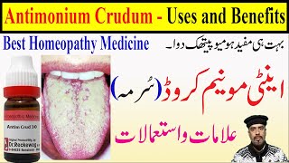 Antimonium Crudum Homeopathy medicine 6C 30C 200C 1M 10M Antimonium Crudum uses in Hindi [upl. by Eicirtap120]